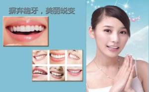 南阳市口腔医院龅牙矫正的方法你知道几个?