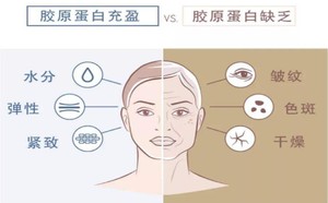 北京京美医疗美容诊所的胶原蛋白美容功效怎么样?