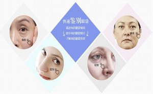 邯郸金皇后医疗美容诊所好吗|眼袋吸脂的优势怎样?