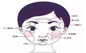 长沙爱思特整形医院黄安华介绍自体脂肪面部填充能保持多久?